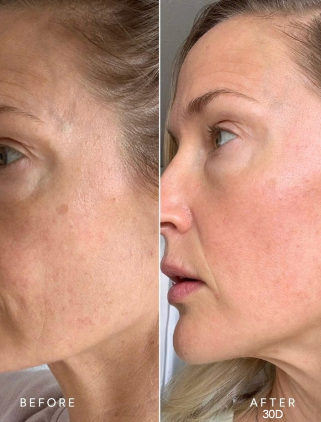 CAVIARA LIFTINGA SERUMS AR HIALURONSKĀBI – 30ml